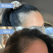 Natural Look Purify Anti-Dandruff Treatment Pack